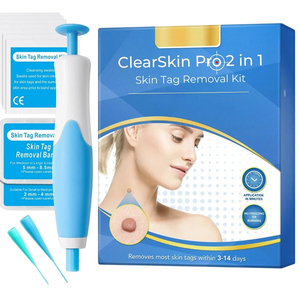 ClearSkin Pro Auto Skin Tag Remover tool with applicator pen and bands for easy at-home skin tag removal