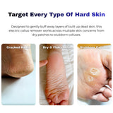 electric callus remover targeting cracked heels dry skin and stubborn calluses