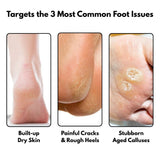 Common foot issues like dry skin, cracked heels, and calluses treated by SilkySole Electric Callus Remover